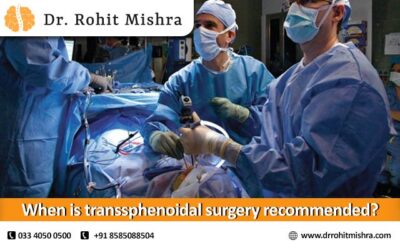 When is transsphenoidal surgery recommended?