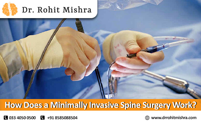 How Does a Minimally Invasive Spine Surgery Work?