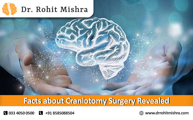 Facts about Craniotomy Surgery Revealed