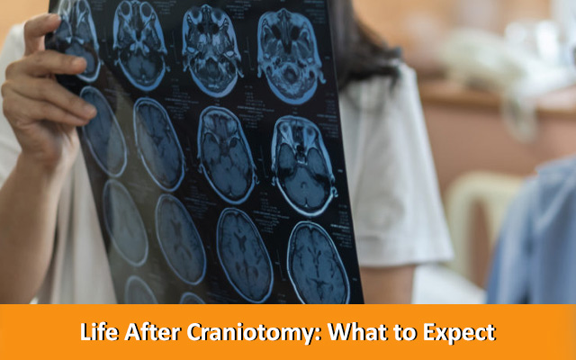 Life After Craniotomy: What to Expect