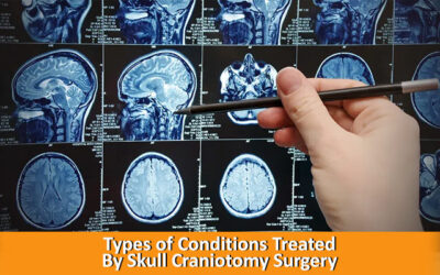 Types of Conditions Treated By Skull Craniotomy Surgery