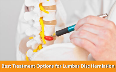 Best Treatment Options for Lumbar Disc Herniation