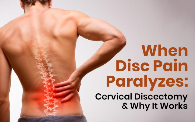When Disc Pain Paralyzes: Cervical Discectomy & Why It Works